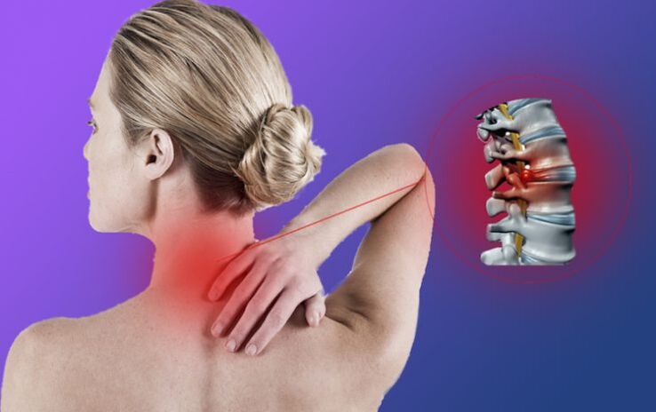 Mugurkaula iekaisums ar dzemdes kakla osteohondrozi