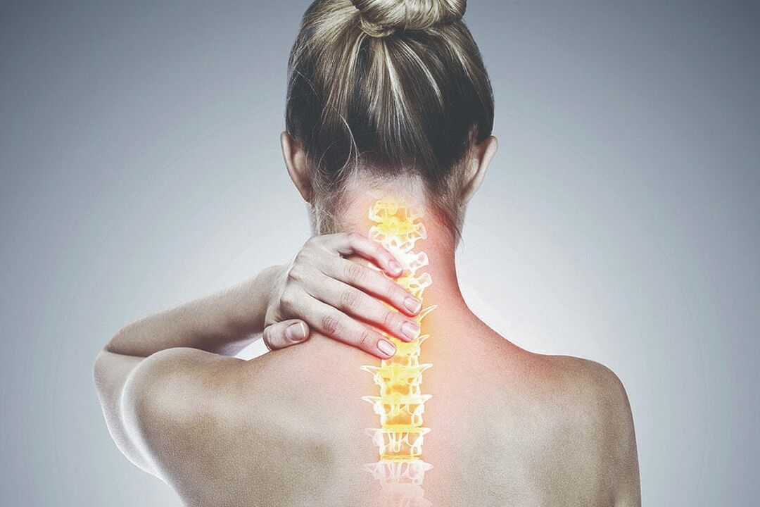 Dzemdes kakla osteohondroze