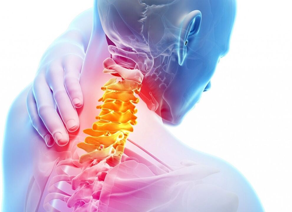 Kas ir dzemdes kakla osteohondroze