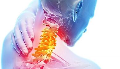 dzemdes kakla osteohondrozes cēloņi