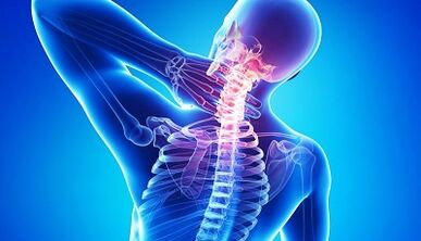 mugurkaula kakla mugurkaula osteohondrozes komplikācijas
