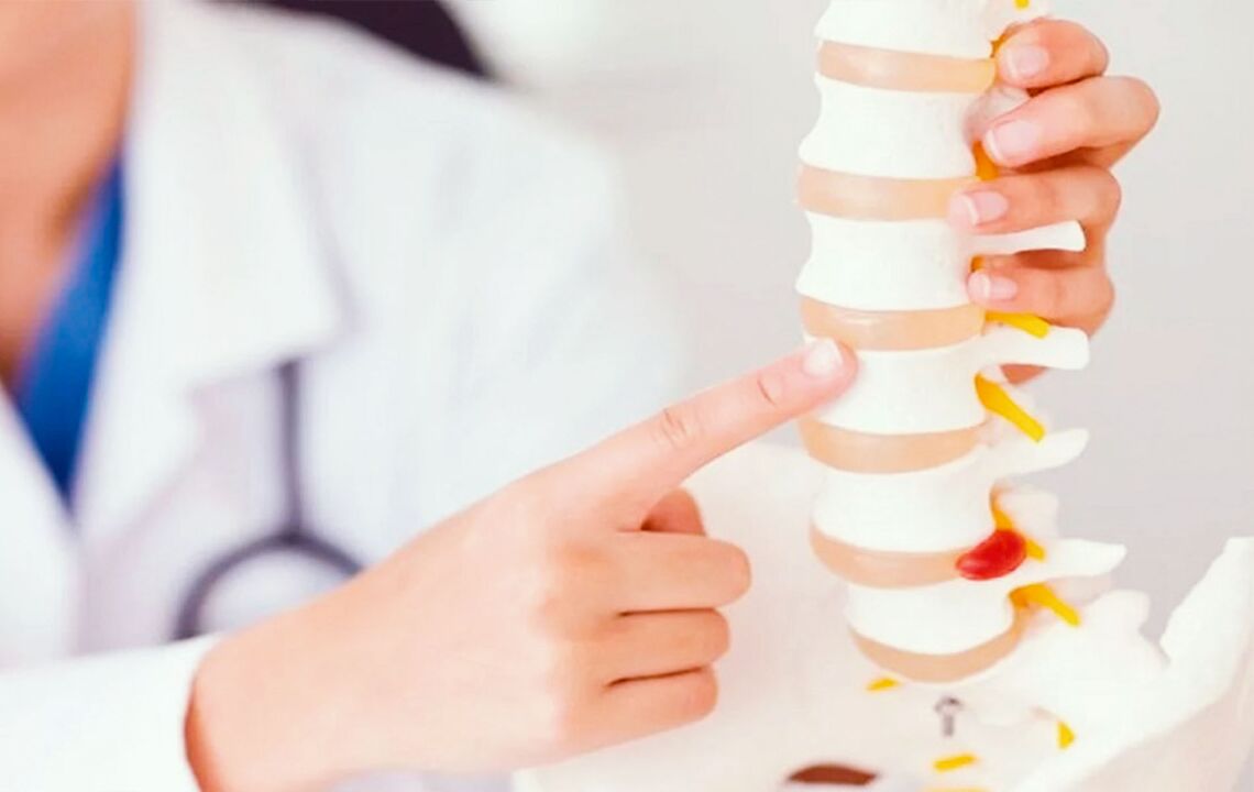 mugurkaula bojājumi dzemdes kakla osteohondrozes dēļ